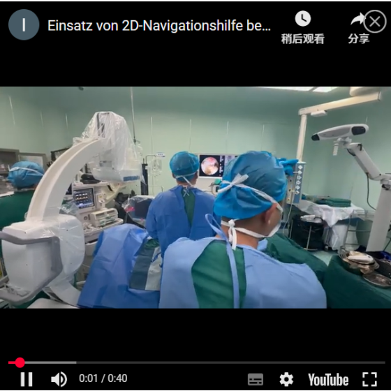 Two-dimensional navigation combined with QuNaMai endoscope for UBE surgery fusion